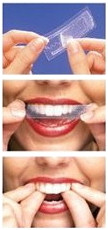 Crest Whitestrips